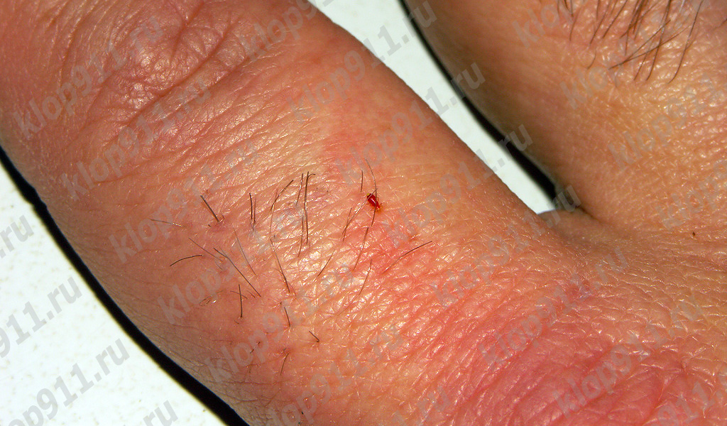 La larva succhia sangue