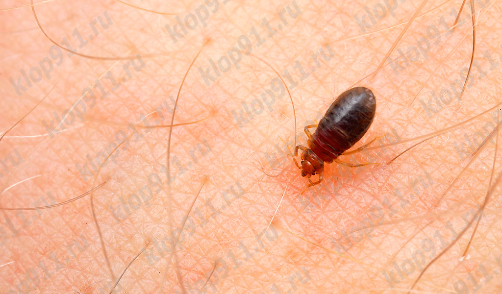 Cimice sazia di sangue